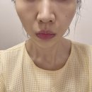 예뻐진 | 일산 윤곽관리 끝판왕! 뱀부테라피로 붓기 타파하고 예뻐진 후기 (feat. 장항동 피부관리)