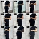 대구 계명대학교 동산병원 - 쌍둥이 제왕절개 출산 후기 (1) (19층 1인실, 수술 준비, 수술 후기...