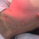 사람들이좋은집 | 집에서 쓰기 좋은 빌라르 목 어깨 안마기 V2 솔직후기