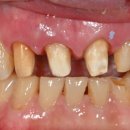 가온치과기공소 이미지