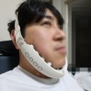 약손명가 올리밴드 내돈내산 후기 사용방법 및 부작용 수포 O
