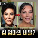 셀럽성형외과의원 | [셀럽얼굴분석🧪]미국에서 난리난 킴카다시안 엄마.. 성형외과 전문의도 놀란 변화 수준ㄷㄷ