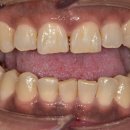 청량리연세휴치과의원 | 청량리치과 후기 믿고 갔다가 후회했습니다. 광고 구분법