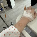 더웰병원 | 더웰병원 편도수술후기 30대 가보자고 (첫날)