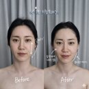 메고지고(부산서면역점) | 부산괴정동피부관리 30대 직장인, 얼굴비대칭부터 골반까지 잡힌 후기 : 스페이스뷰티 부산대티점