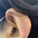 이화보청기 이미지