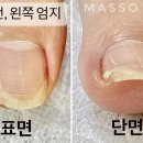은영신발 이미지