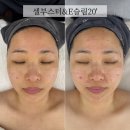 경화에스테틱 | [마곡 피부관리] 움트다 에스테틱 2회차 내돈내산 후기 이번엔 진짜 확신이 생겼다