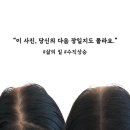 채도스칼프 이미지