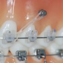 서울에스(S)치과교정과치과의원 이미지