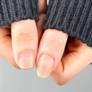 빨간손톱 - 계양구 | 광주 짧은손톱교정 후기 [손톱바디길이비교]