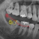 나무가있는치과의원 이미지