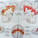 뇌의 구조와 기능 이미지
