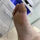 동성영화타운(아) | 대전 탄방동 발각질 제거 깔끔 완벽 페디쿱스 동성풀리메디