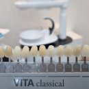 나라치과기공소 이미지