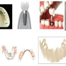 디지털(DIGITAL) 치과기공소 이미지