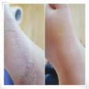 라라샾 동두천1호점 | 동두천 지행역 내성발톱 무좀발톱 발톱무좀 발각질 체계적인 케어 코디풋네일