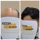 김해 양산 남자가발 미용실 인모 정수리 탈모 맞춤 전문점 헤어마루 모이든 덕천점 추천후기