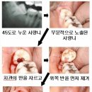 심훈치과의원 네이버블로그