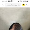 커버스토리뷰티스칼프 - 6473 | 커버스토리뷰티스칼프