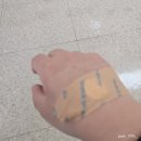 GS25전주기독병원점 | 좌천 일신기독병원 위•대장 내시경 (수면내시경)