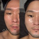 용산-297 | 용산피부관리 받으러 숙대입구역 얼짱몸짱 숙대점 에서 윤곽관리