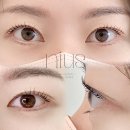 니어스 아이래쉬