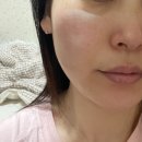 아드망 | 내돈내산 후기 항당화 스킨케어 아드망 앰플 로션 선크림 까지