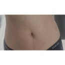 외 제 | 복부 지방분해주사 5회차 후기 부작용 통증 효과 가격 주의사항