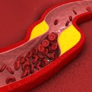 바디피트니스 이미지