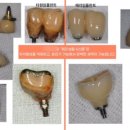 장치과기공소 이미지