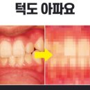 장원치과의원 네이버블로그
