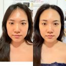 월드컵로 30 세븐일레븐 앞 | 마포 피부관리 이모아에스테틱 에너지테라피 솔직후기 (마포구 예신 추천)