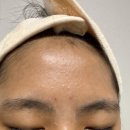 DC땡 | [홈쎄라 플라닉프로] 모공,흡수,탄력 한방에 끝나는 똑똑한 홈케어 플라닉프로 2주 실제 사용후기