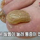 레푸스 화정점 네이버블로그