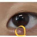 윤안과의원 이미지