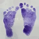 B56 | B56. 제왕절개 4-5일차 후기 및 퇴원