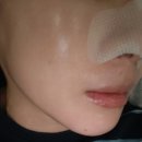 스킨데이 | 동백역 왁싱전문점 모데이왁싱 스킨플래닝 후기