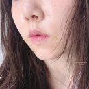 홍대 팔자주름 :: 홍대 쥬베룩 볼륨 2회차 맞고 온 썰!