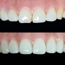 이세상치과기공소 이미지