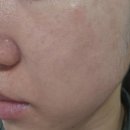 서울강남비뇨의학과의원 | W16_ 포항 서울강남 라운지S 피부과