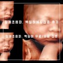 수영구보건소 | 임신 30주 입체초음파 백일해 부산진구보건소 무료유료 예방접종 후기