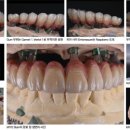 S-D치과기공소 네이버블로그