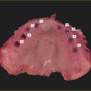 센트릭치과기공소 이미지
