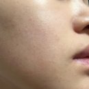 기미세럼 미백스킨케어 헤아림 래디언스 멜라 화이트 세럼 후기