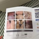 풍암동 여드름관리 깐달걀피부 되는 닥토필 후기 &lt;고운수아피부케어센터&gt;