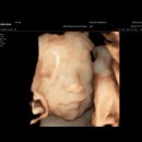 은산부인과의원 | [광진구산부인과] 임신 27주차 /루트여성의원/ 입체초음파/ 백일해주사