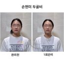 손앤미뷰티스킨 | 대전 윤곽관리 두골비 케어 찐만족 후기ㅣ손앤미뷰티스킨