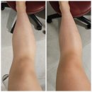 신사 바디관리 '제이윤뷰티' 하체관리 후기
