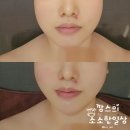 오늘,고운에스테틱